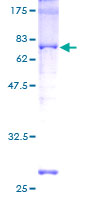 12.5% SDS-PAGE Stained with Coomassie Blue.